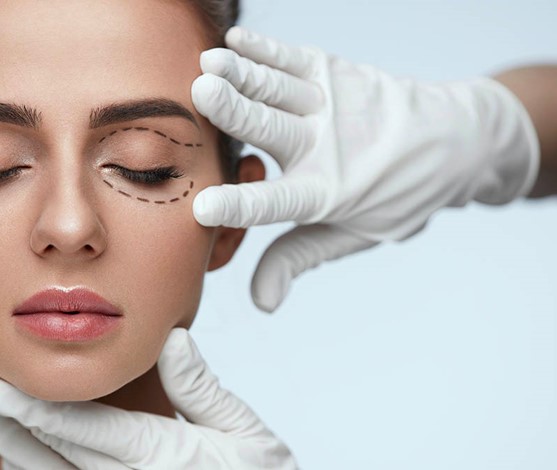 Blepharoplasty: Make your eyes young again